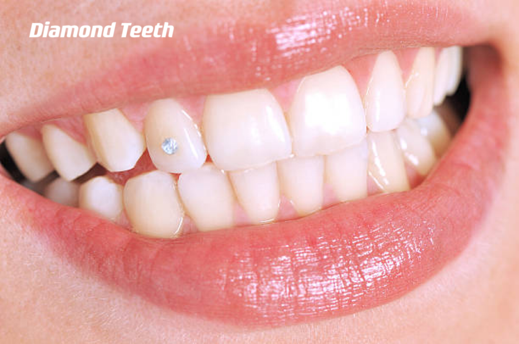 Diamond Teeth ---- OranEden